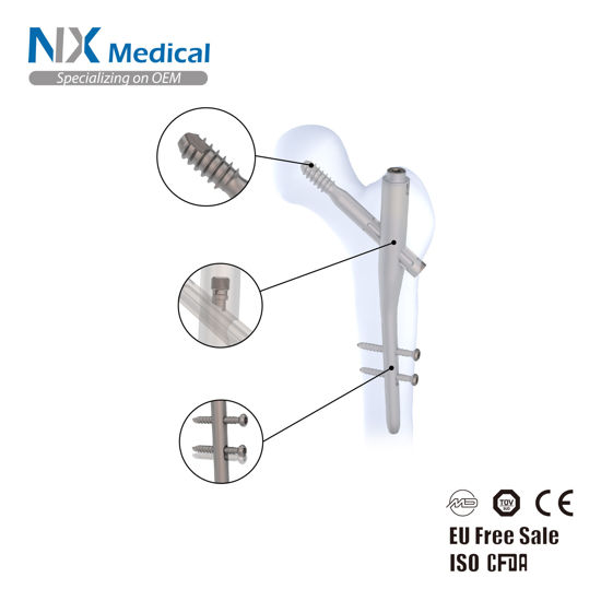 Picture of Gamma C Nail w Pre-loaded Cannulated Set Screw System