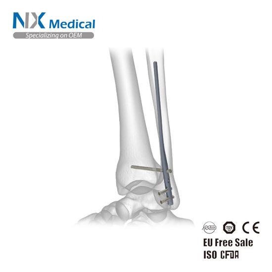 Picture of Fibular Nail System