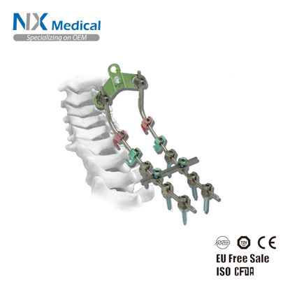 Picture of Posterior Cervical Pedicle Screw & Rod System