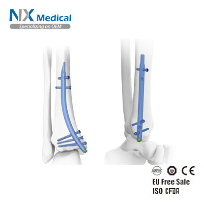 Picture of Distal Tibial Nail System